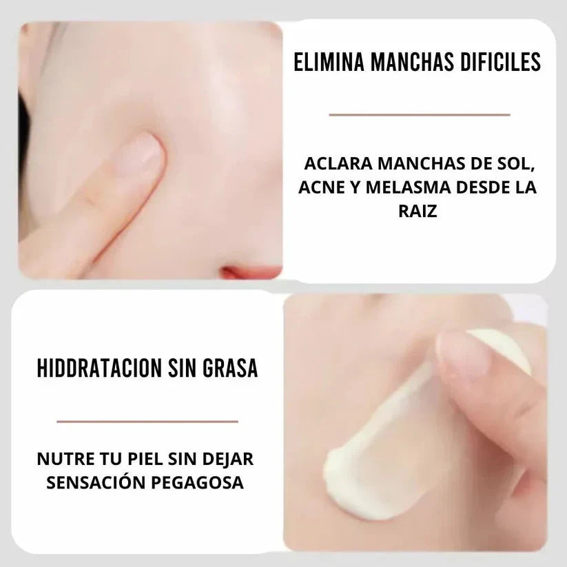 Arbutin White® ✨ Crema Aclarante